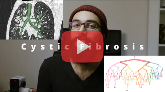 Outreach video - Imaging for Cystic Fibrosis