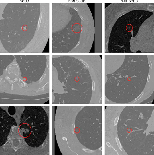 Exploring Fairness and Performance Drivers Across State-of-the-Art Pulmonary Nodule Detection Algorithms