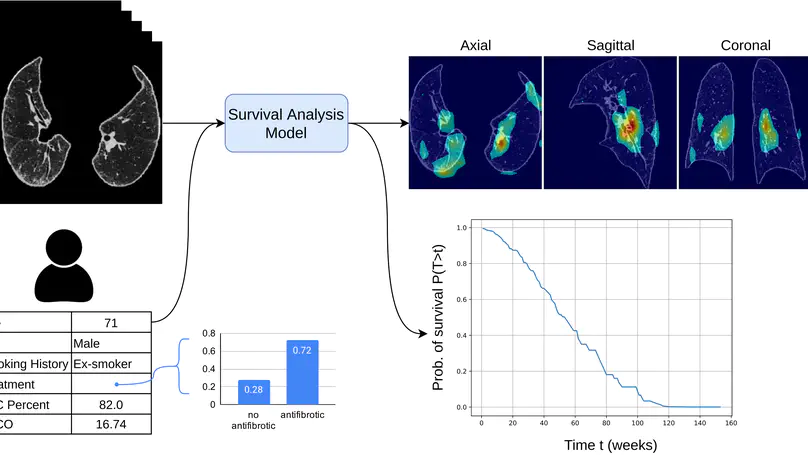 Survival Analysis for Idiopathic Pulmonary Fibrosis using CT Images and Incomplete Clinical Data