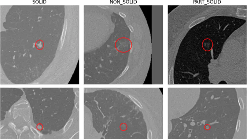 Exploring Fairness and Performance Drivers Across State-of-the-Art Pulmonary Nodule Detection Algorithms