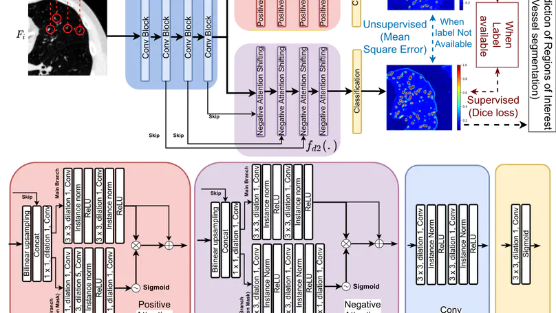 Learning Morphological Feature Perturbation for Semi-Supervised Segmentation