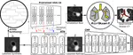 Airway measurement by refinement of synthetic images improves mortality prediction in idiopathic pulmonary fibrosis