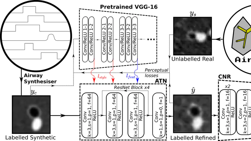 Airway measurement by refinement of synthetic images improves mortality prediction in idiopathic pulmonary fibrosis