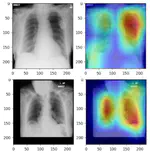Utilisation of deep learning for COVID-19 diagnosis