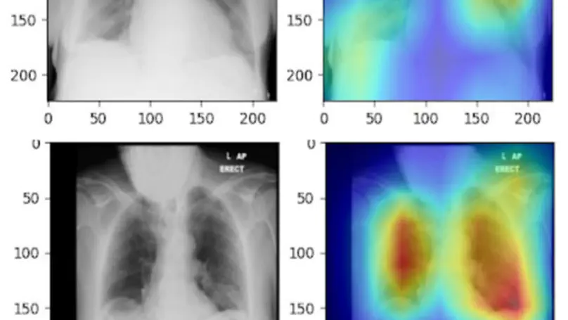 Utilisation of deep learning for COVID-19 diagnosis
